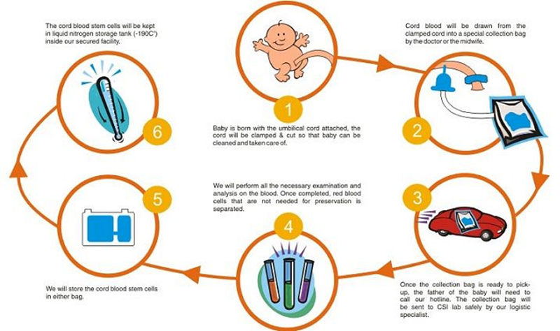 umbilical cord blood banking