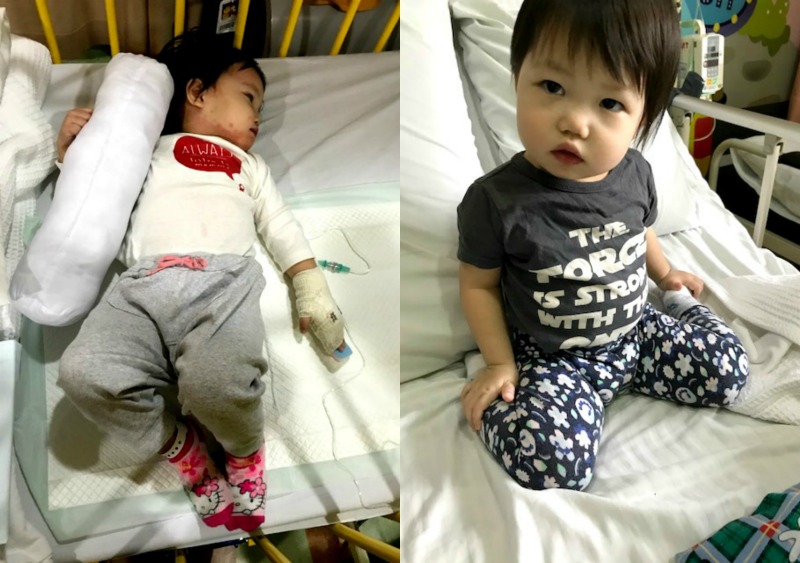 Andrea on admission day (left) and on discharge day (right). (Image Credit: Alison Tham)