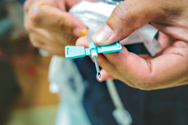 This is the needle that is inserted into a fistula (a widened blood vessel made by surgically sewing together an artery and a vein) in the neck or arm of the patient to draw out and return cleaned blood into the dialysis machine. 