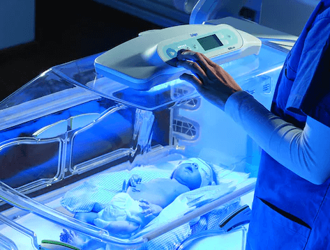 phototherapy for breastfeeding jaundice baby