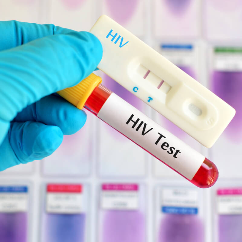 HIV Test