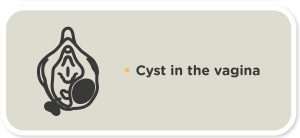 pregnancy myths cyst