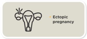 pregnancy myths ectopic