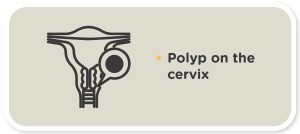 pregnancy myths polyp